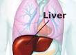 Having a Liver Transplant