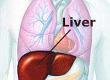 What Does a Liver Transplant Involve?