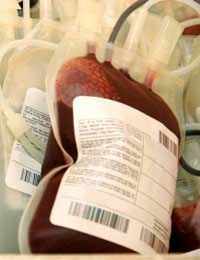 Blood Transfusion Risks During Blood